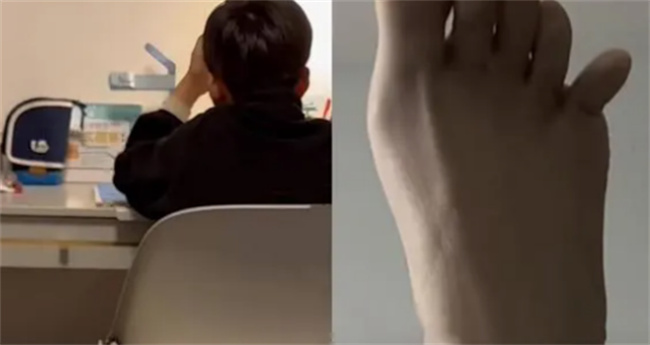 女子輔導(dǎo)兒子作業(yè)情緒崩潰踹斷腳趾 如何輔導(dǎo)孩子寫作業(yè)