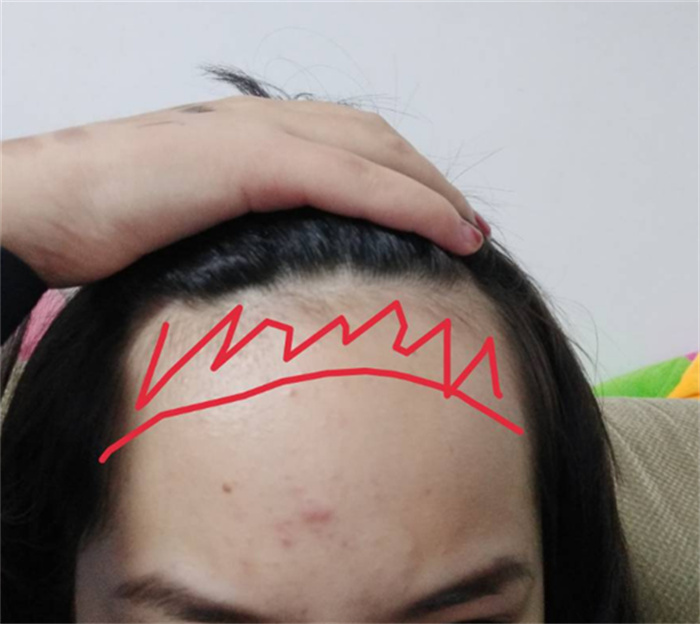 額頭比較方正的人 學(xué)歷一般都比較高（額頭方正）