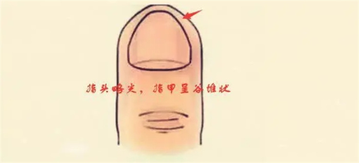 一指定乾坤，四種中指形狀看你是富是窮，你是哪種就是什么命！