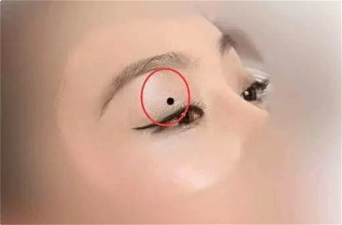 臉上這五個(gè)地方長(zhǎng)痣，最影響婚姻和事業(yè)，導(dǎo)致婚姻破裂、事業(yè)低迷