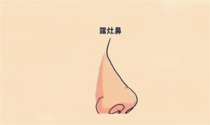 ķN©ؔʧI(y)yһD