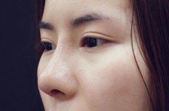 鼻梁起節(jié)的女人好命是真的嗎?為人自我愛做主自私自利命運(yùn)差