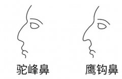 駝峰鼻的男人的命運(yùn)：生性冷漠意志力強(qiáng)個(gè)性偏執(zhí)容易失敗