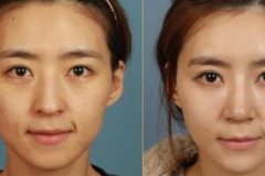 駝峰鼻的女人運(yùn)勢(shì)好不好?事業(yè)難成婚姻不順，整體運(yùn)勢(shì)不夠好