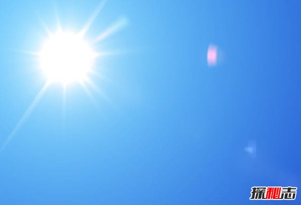 世界上十大最奇葩的過(guò)敏 最奇葩的過(guò)敏原讓你驚呆