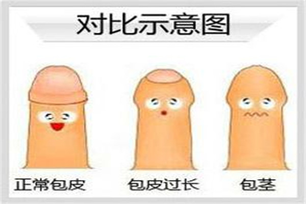 割包為什么很多人后悔 割包好處和壞處有哪些