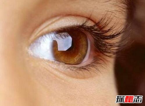 眼皮跳測(cè)吉兇是真的嗎,按時(shí)辰分析眼皮跳吉兇