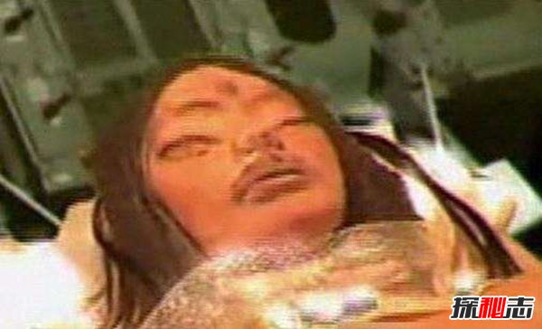 月球上的三眼女尸真相,三眼女尸被發(fā)現(xiàn)時(shí)竟然還活著