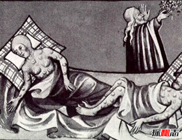 苦不堪言!人類歷史上的十大瘟疫,云南重大鼠疫死亡人數(shù)達10萬多