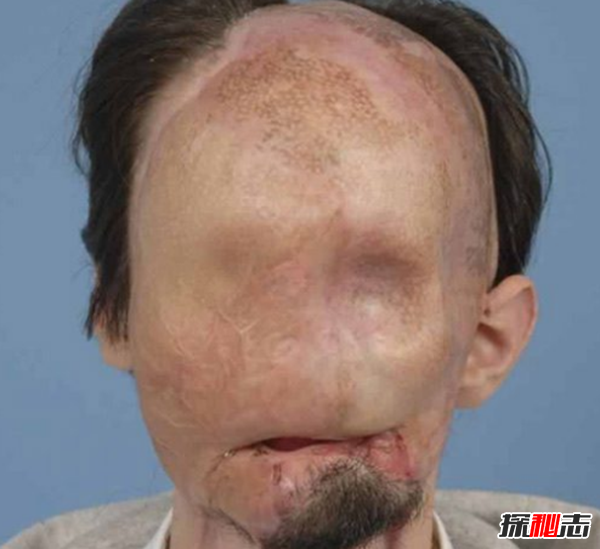 世界上十大最古怪的男人,20歲小伙沒(méi)有臉可以活兩年