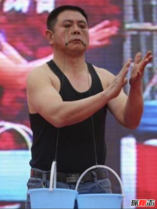 世界上十大最古怪的男人,20歲小伙沒(méi)有臉可以活兩年