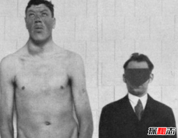 世界上十大最古怪的男人,20歲小伙沒(méi)有臉可以活兩年
